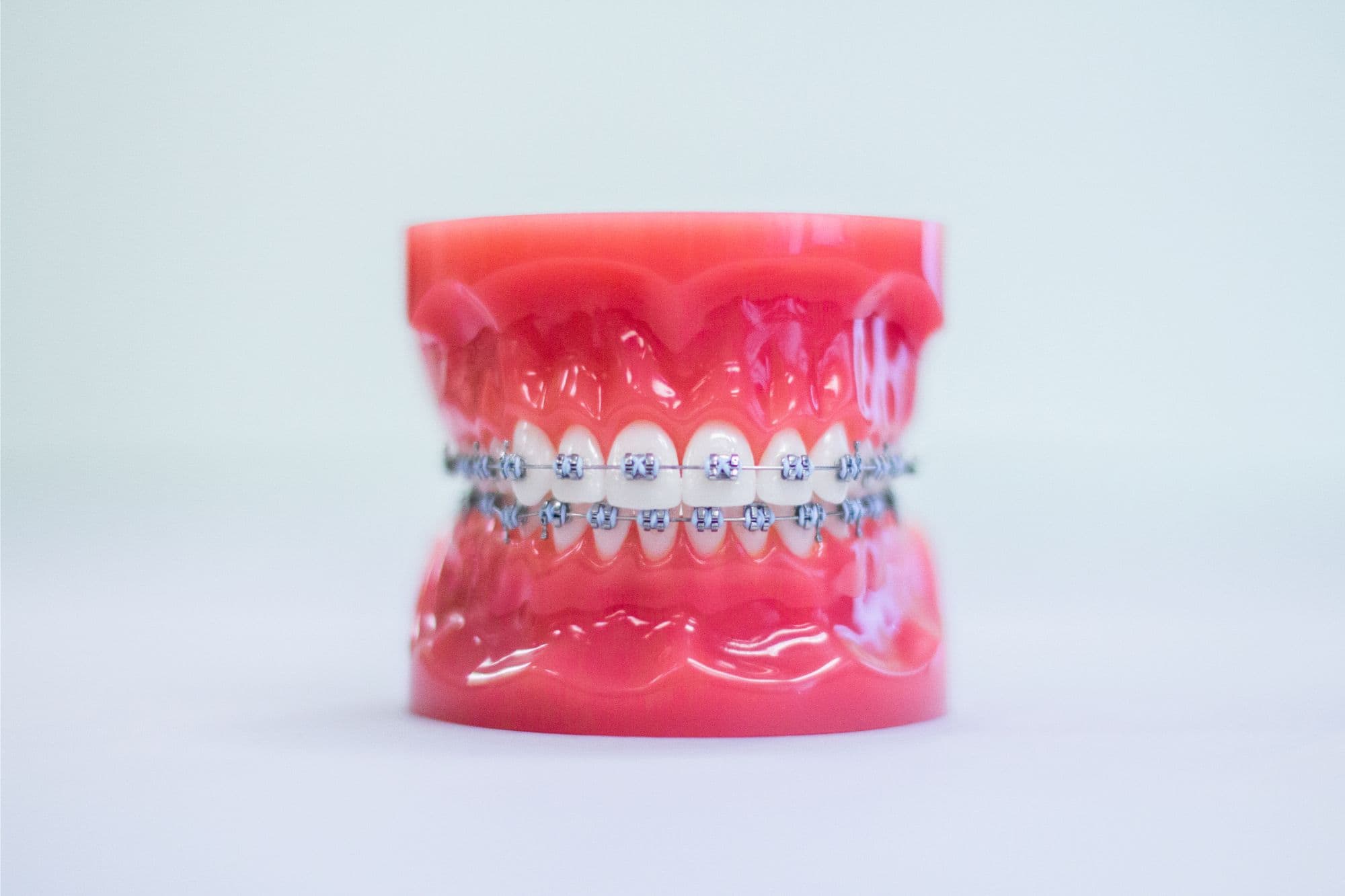 IMG_5819 milford orthodontist